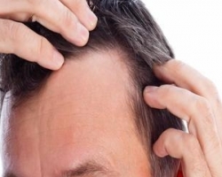 ֲ�������� ֲ�����ŵ�����Щ ֲ����������